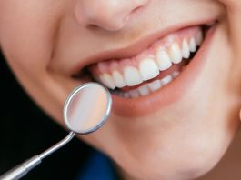 עיצוב שפתיים